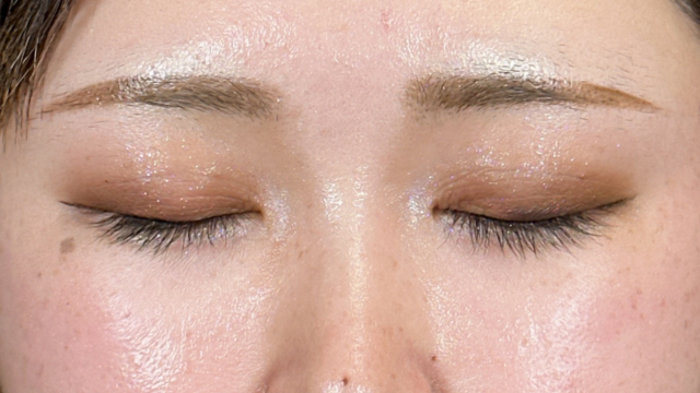 手術前の状態 その1