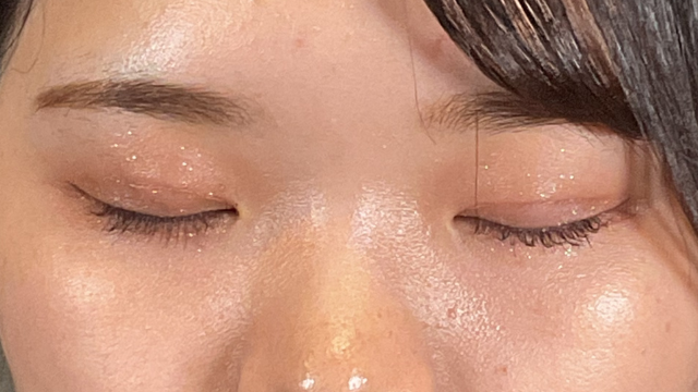 手術前の状態 その1