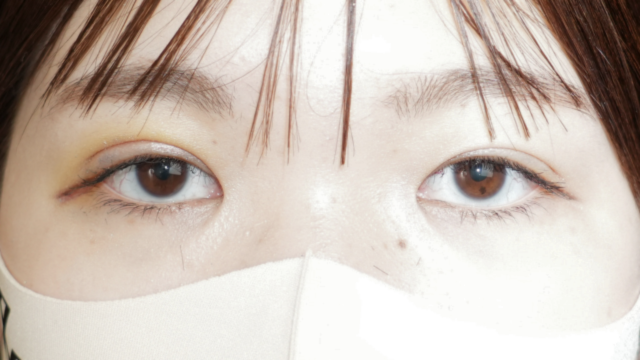 手術前の状態 その1