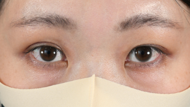 手术前的状态 其一