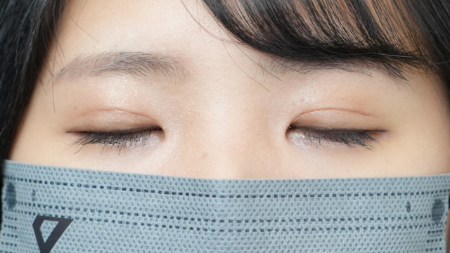 手术前的状态 其一