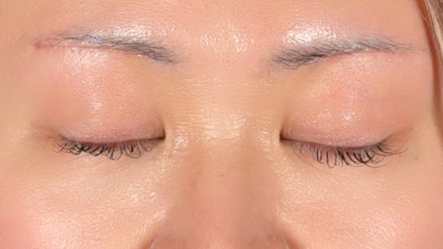 Postoperative Condition Part 1