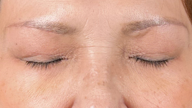 Postoperative Condition Part 1