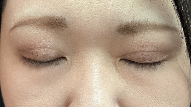 手術前の状態 その1