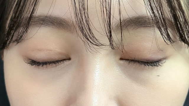 手术前的状态 其一