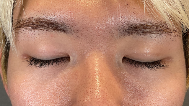 Postoperative Condition Part 1