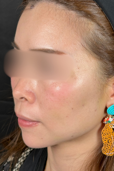 Postoperative Condition Part 1