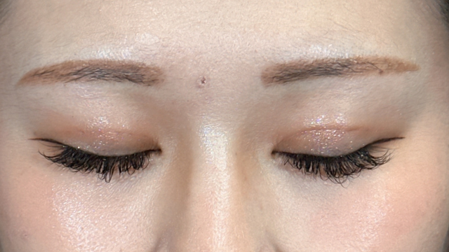 手术前的状态 其一