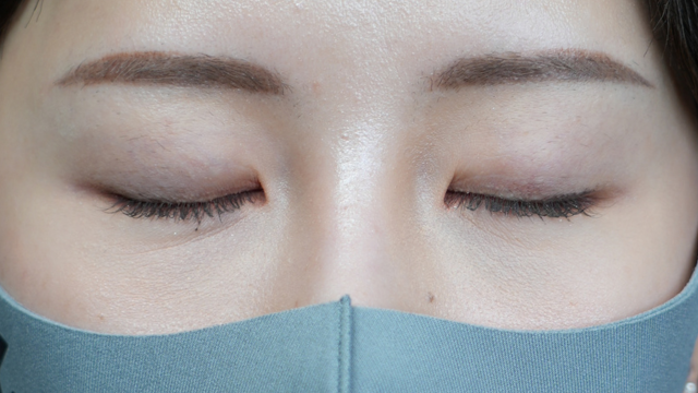 手术前的状态 其一