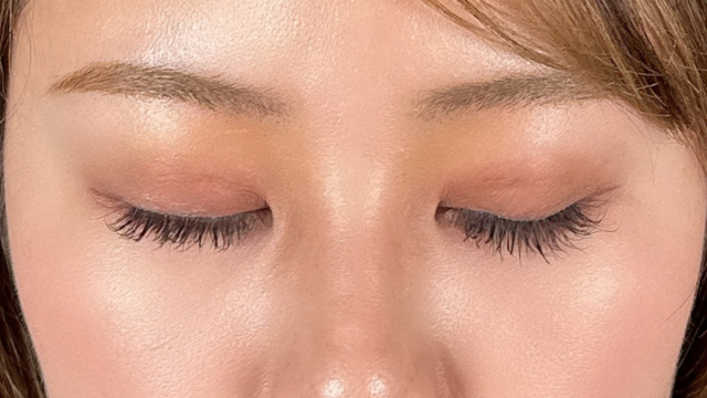 手术前的状态 其一