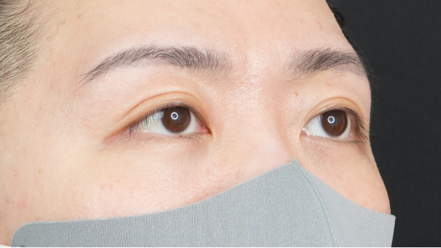 手术前的状态 其一