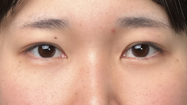 Postoperative Condition Part 1