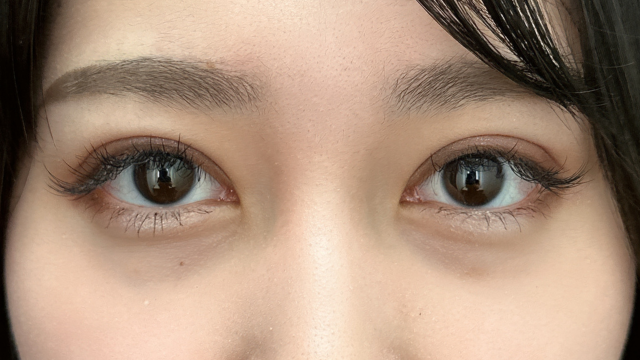 Postoperative Condition Part 1