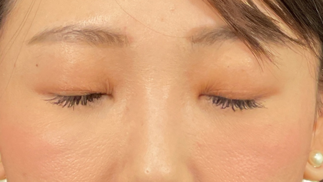 Postoperative Condition Part 1