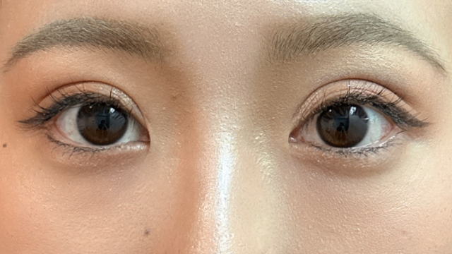 手術前の状態 その1