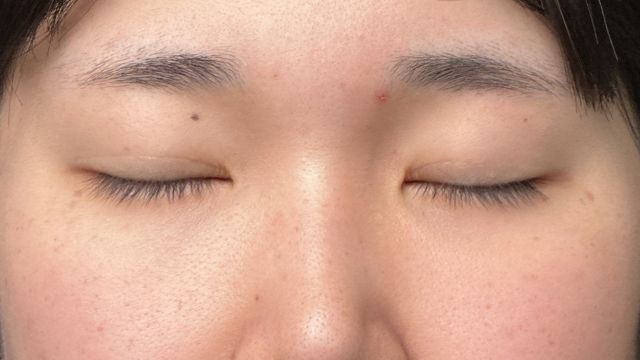 Postoperative Condition Part 1