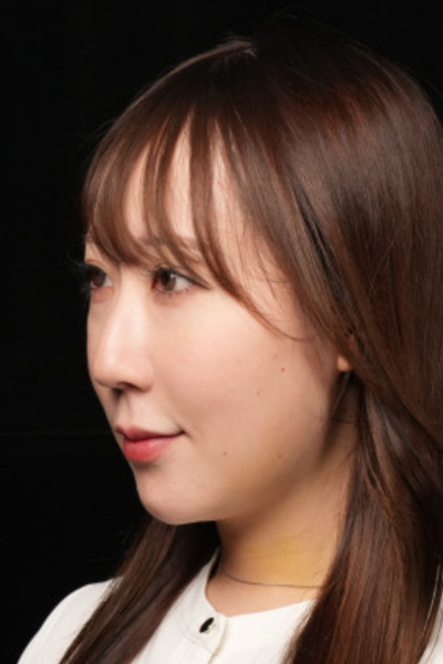 手术前的状态 其一