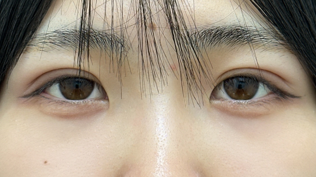 Postoperative Condition Part 1