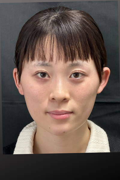 手術前の状態 その1