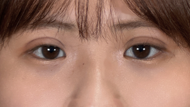 手术前的状态 其一