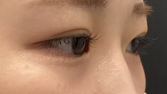 手术前的状态 其一