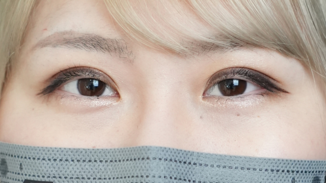 手术前的状态 其一