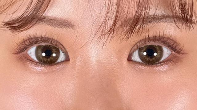 手术前的状态 其一