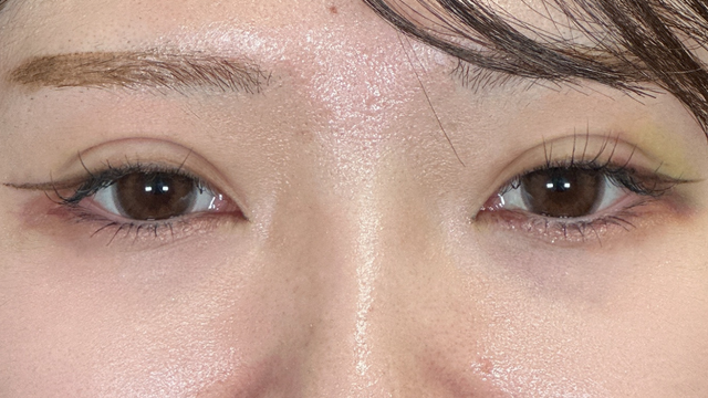 手术前的状态 其一