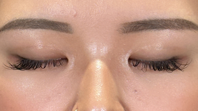 手術前の状態 その1