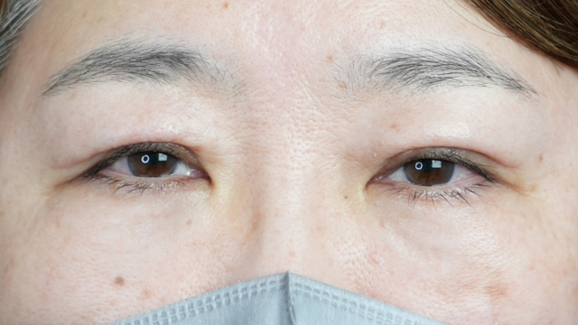 Postoperative Condition Part 1