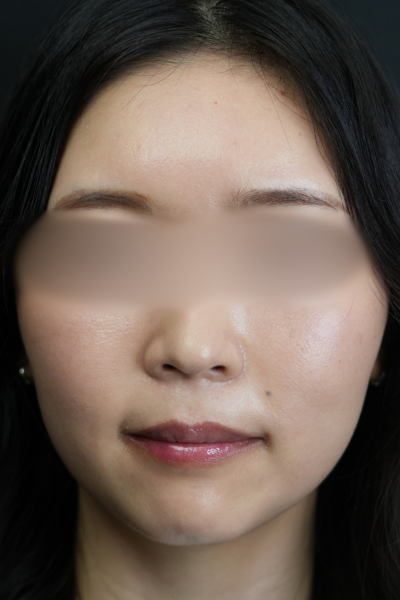 Postoperative Condition Part 1