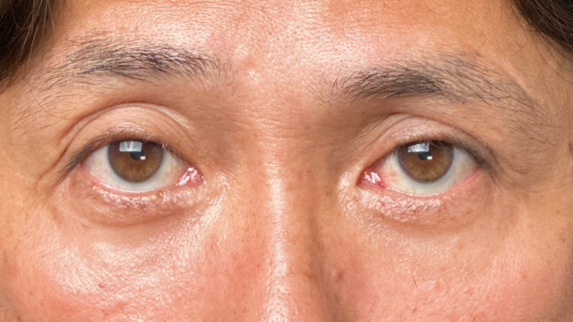 手术前的状态 其一