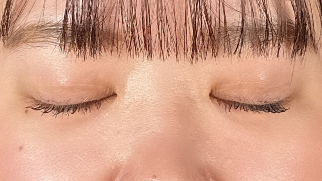 手术前的状态 其一