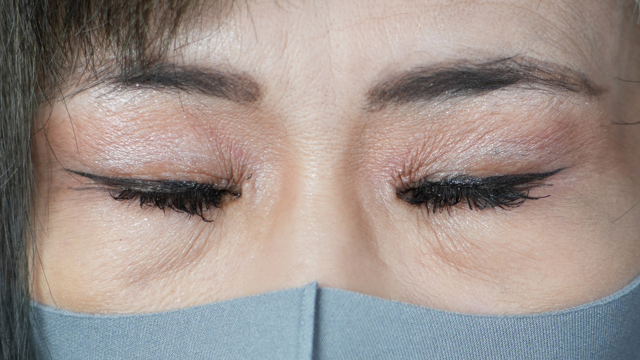 手术前的状态 其一