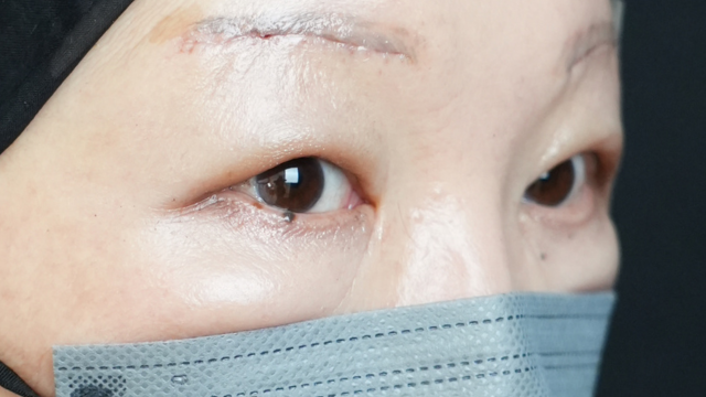 Postoperative Condition Part 1