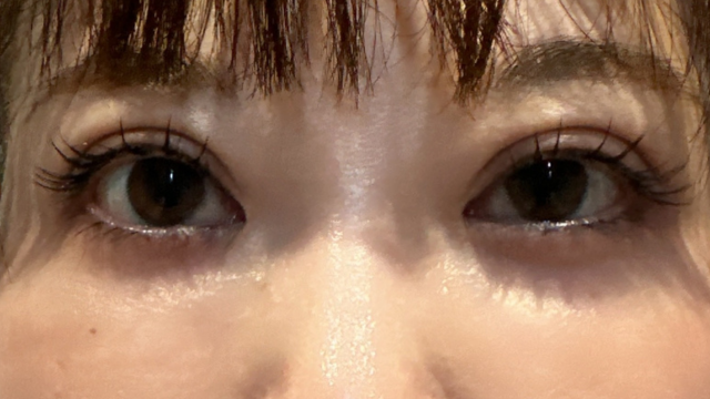 手术前的状态 其一