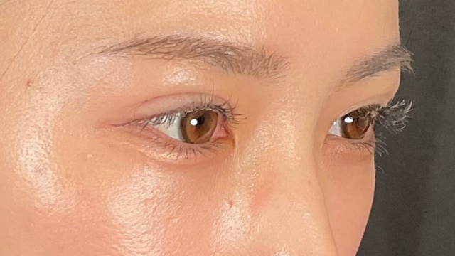 手术前的状态 其一