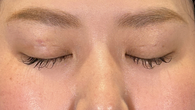 手术前的状态 其一