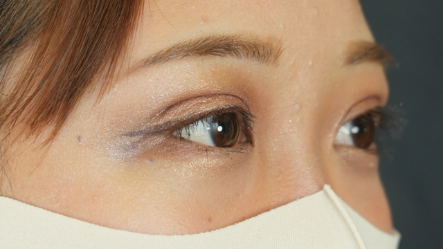 手術前の状態 その1