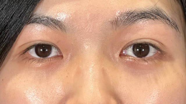 手术前的状态 其一