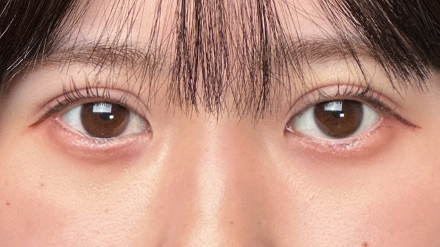 手术前的状态 其一