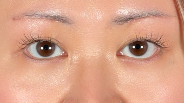 Postoperative Condition Part 1