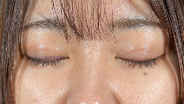 手术前的状态 其一