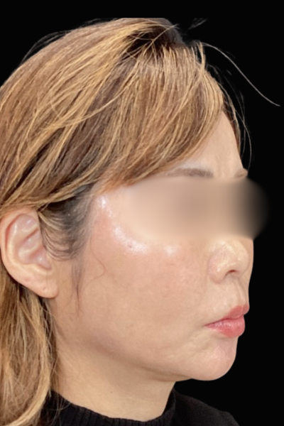 手術前の状態 その1