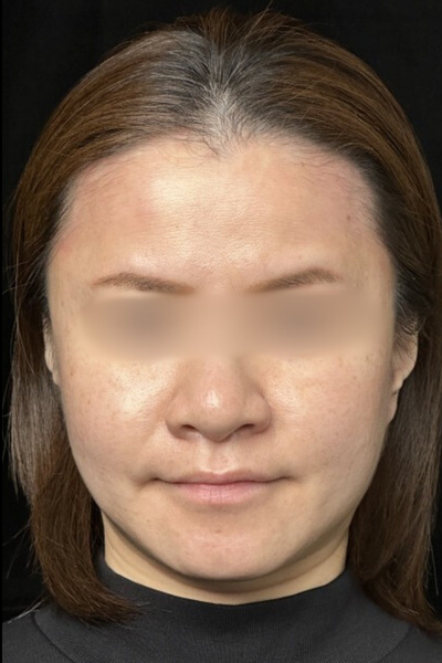 手術前の状態 その1