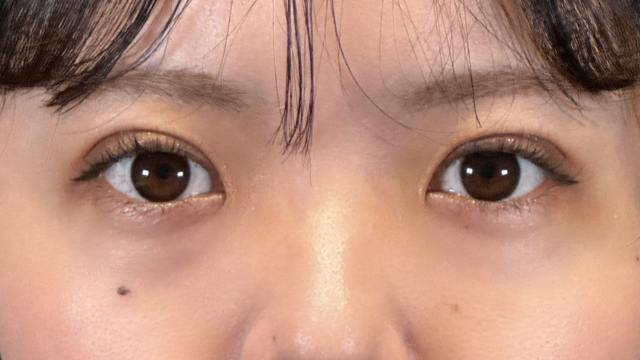 手術前の状態 その1