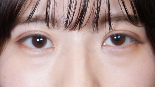 手术前的状态 其一