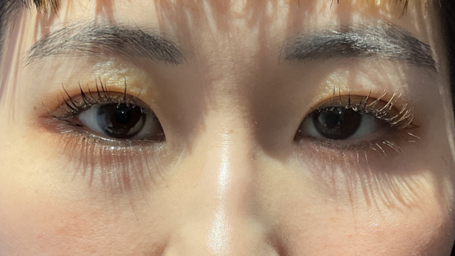 手术前的状态 其一