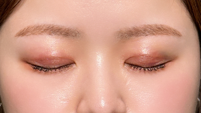 手术前的状态 其一