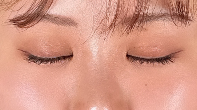 手术前的状态 其一